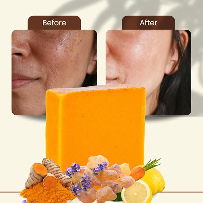 Turmeric Skin Cleansing Soap - Natural Glow Face & Body Cleanser for Acne, Dark Spots & Scars, Gentle for All Skin Types - 2 Bars (4.5 oz)