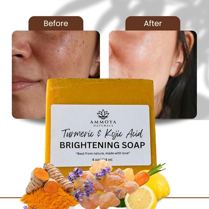 Turmeric Skin Cleansing Soap - Natural Glow Face & Body Cleanser for Acne, Dark Spots & Scars, Gentle for All Skin Types - 1 bar (4.5 oz)
