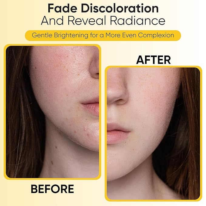 Turmeric Kojic Acid Cleansing Pads, 50 Pcs Kojic Acid And Turmeric Cleansing Pads for All Skin Types, Exfoliating Cotton Rounds, Dark Spots Remover for Face, Deep Clean Pores
