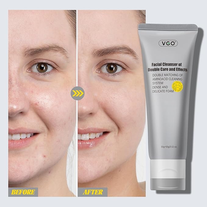 VGO Facial Cleanser, Daily Face Wash of Double Care and Effects, Cleansing Mud Mask & Amino Acid Cleansing All in One Gentle Face Cleanser, 3.52 Oz