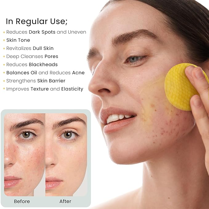 Turmeric Kojic Acid Cleansing Pads, 50 Pcs Kojic Acid And Turmeric Cleansing Pads for All Skin Types, Exfoliating Cotton Rounds, Dark Spots Remover for Face, Deep Clean Pores