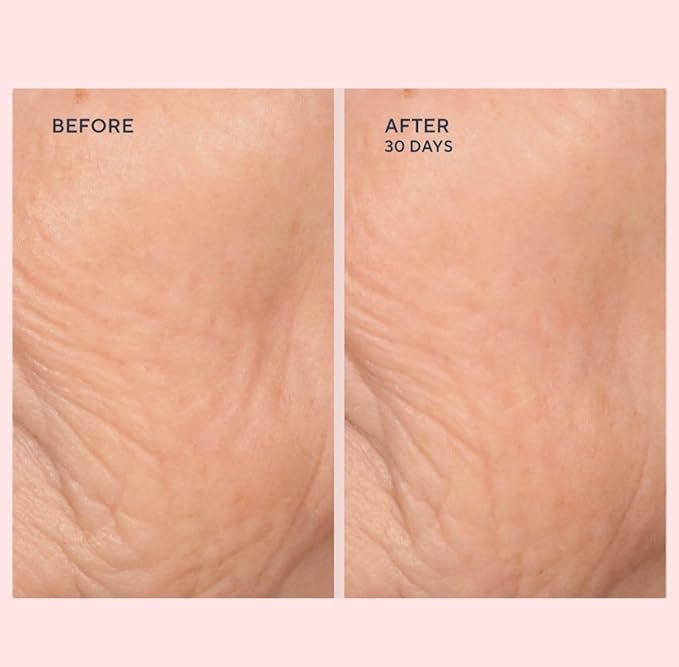 Serious Skincare - C-Extreme Results Facial Exfoliator - Deep Pore Cleansing & Resurfacing Skin Treatment - Vitamin C, Collagen & Natural Fruit Enzymes - For Smoother Radiant Face & Neck - 2 fl. oz