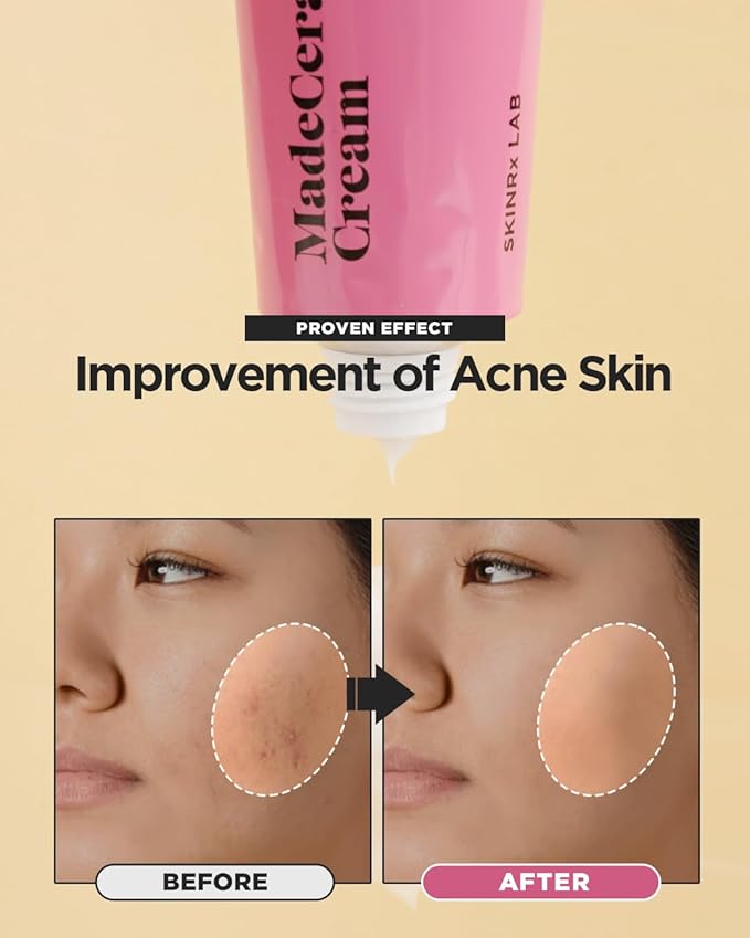 SKINRxLAB Made Cera Cream - Acne & Redness Relief Face Moisturizer, Sebum Control, Improving Skin Barrier with Ceramide and Madecassoside, Anti-Aging and Pore Minimizing Face Cream, 1.69 + 0.5 fl.oz.