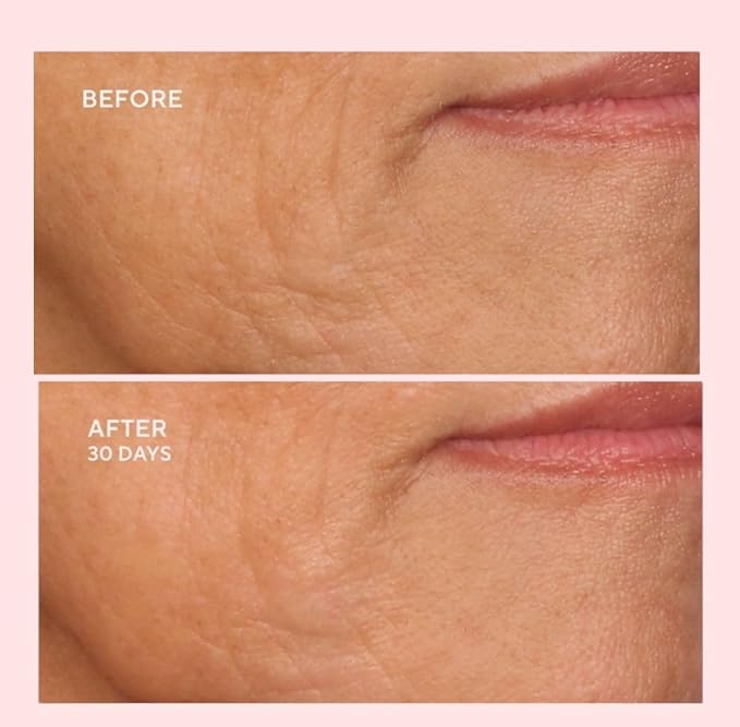 Serious Skincare - C-Extreme Results Facial Exfoliator - Deep Pore Cleansing & Resurfacing Skin Treatment - Vitamin C, Collagen & Natural Fruit Enzymes - For Smoother Radiant Face & Neck - 2 fl. oz