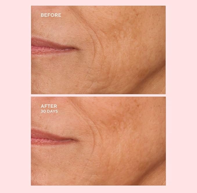 Serious Skincare - C-Extreme Results Facial Exfoliator - Deep Pore Cleansing & Resurfacing Skin Treatment - Vitamin C, Collagen & Natural Fruit Enzymes - For Smoother Radiant Face & Neck - 2 fl. oz