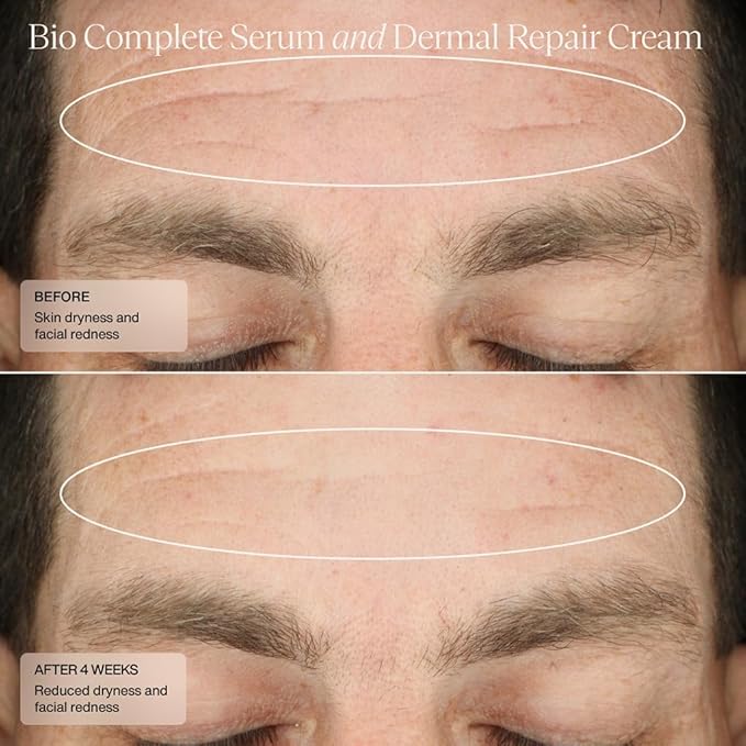 Senté The Repair Duo with Bio Complete Serum & Dermal Repair Cream - AntiAging Skincare Kit for Sensitive Skin, Fine Lines & Wrinkles, Redness & Deep Hydration.With Retinol & Vitamin E(1.0oz & 1.7oz)