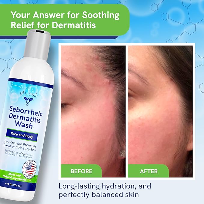 Seborrheic & Atopic Dermatitis Gentle Face Wash with Manuka Honey - Natural & Organic Face Cleanser & Body Wash For Sensitive Skin - Hypoallergenic, Paraben Free & Sulfate Free Acne Face Wash (8oz)